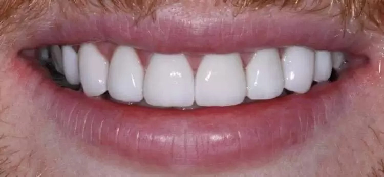 Emergency dentist in Westminster | Made in London Dental gallery image 2