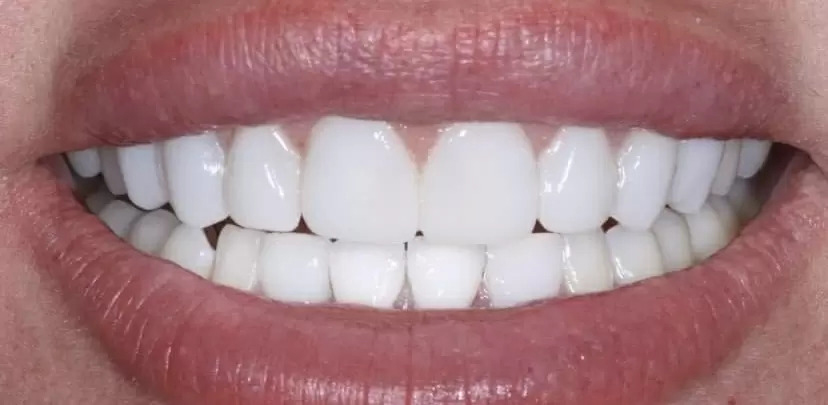 Emergency dentist in Westminster | Made in London Dental gallery image 1