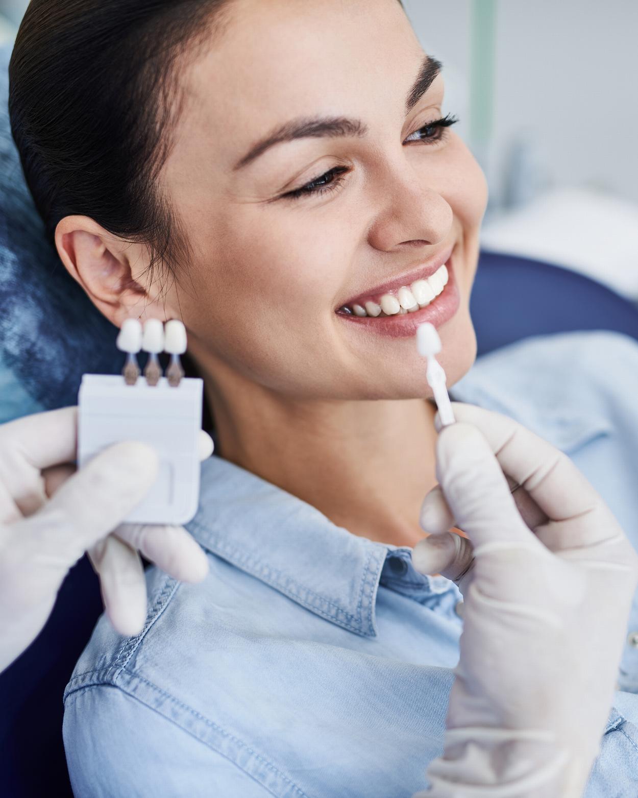 Woman having veneers colour matched